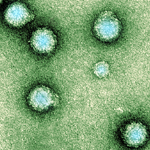 Chikungunya-Virus